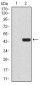MMP14 Antibody